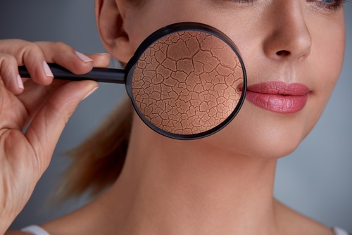Dr. Michael A. Persky - Hot News! Heat: A New Cause of Premature Aging