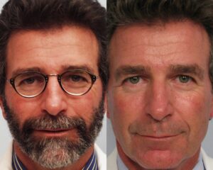 Dr. Michael A. Persky - Tell Me Santa, What is it That Bothers You About Your Appearance?