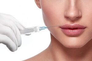 Dr. Michael A. Persky - Minimizing Bruising After Facial Filler Injections