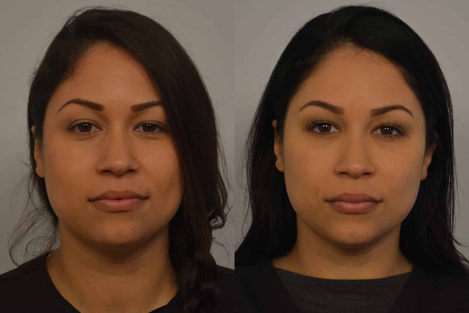 Dr. Michael A. Persky - When You Look Marvelous… Millennials, Botox, and Natural Beauty