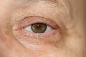 Dr. Michael A. Persky - Opening Up the Eyes for Better Vision