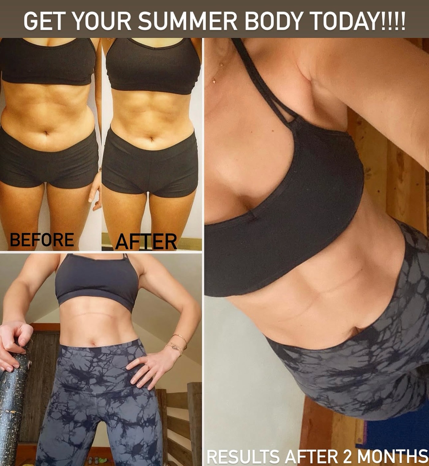 Before and After Body Contouring