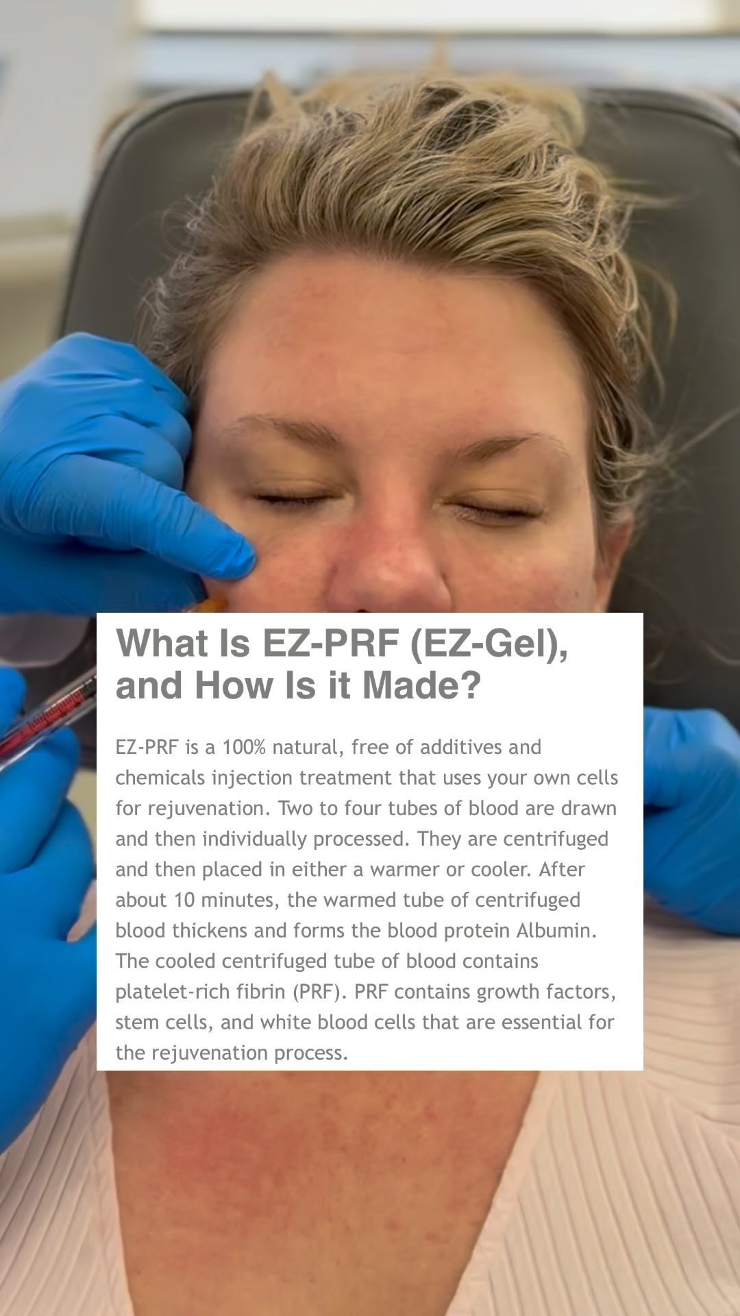 Dr. Persky answers What is EZ-PRF (EZ-Gel) and how is it Made?