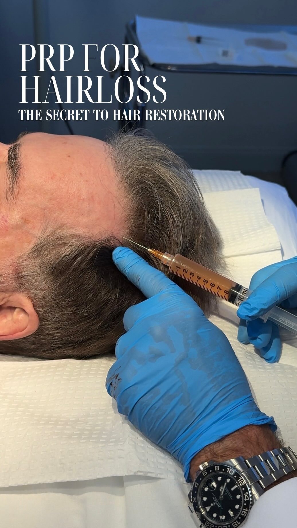 Man getting PRP Hair Injection