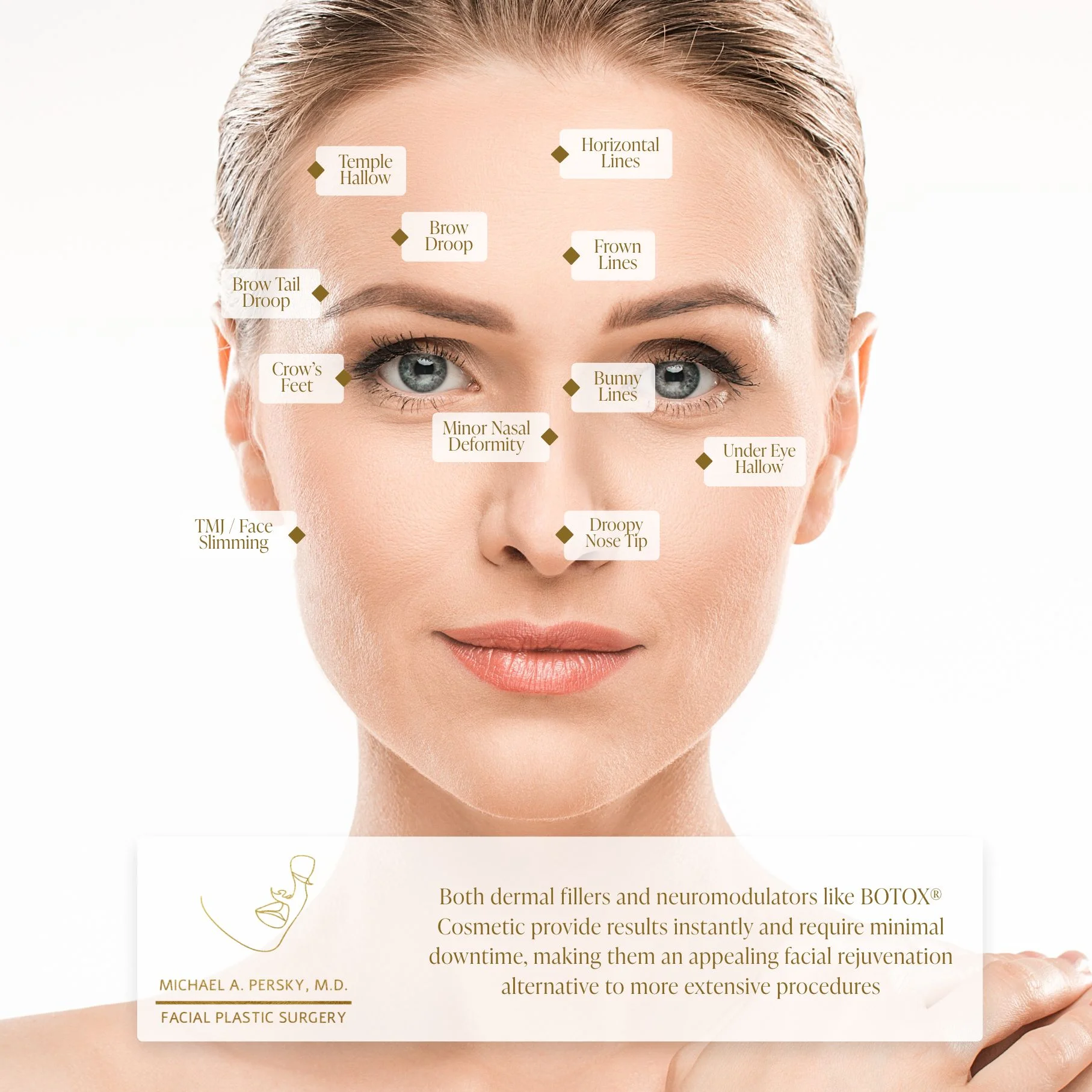 Fillers and Injectables Guide | Dr. Persky Los Angeles CA