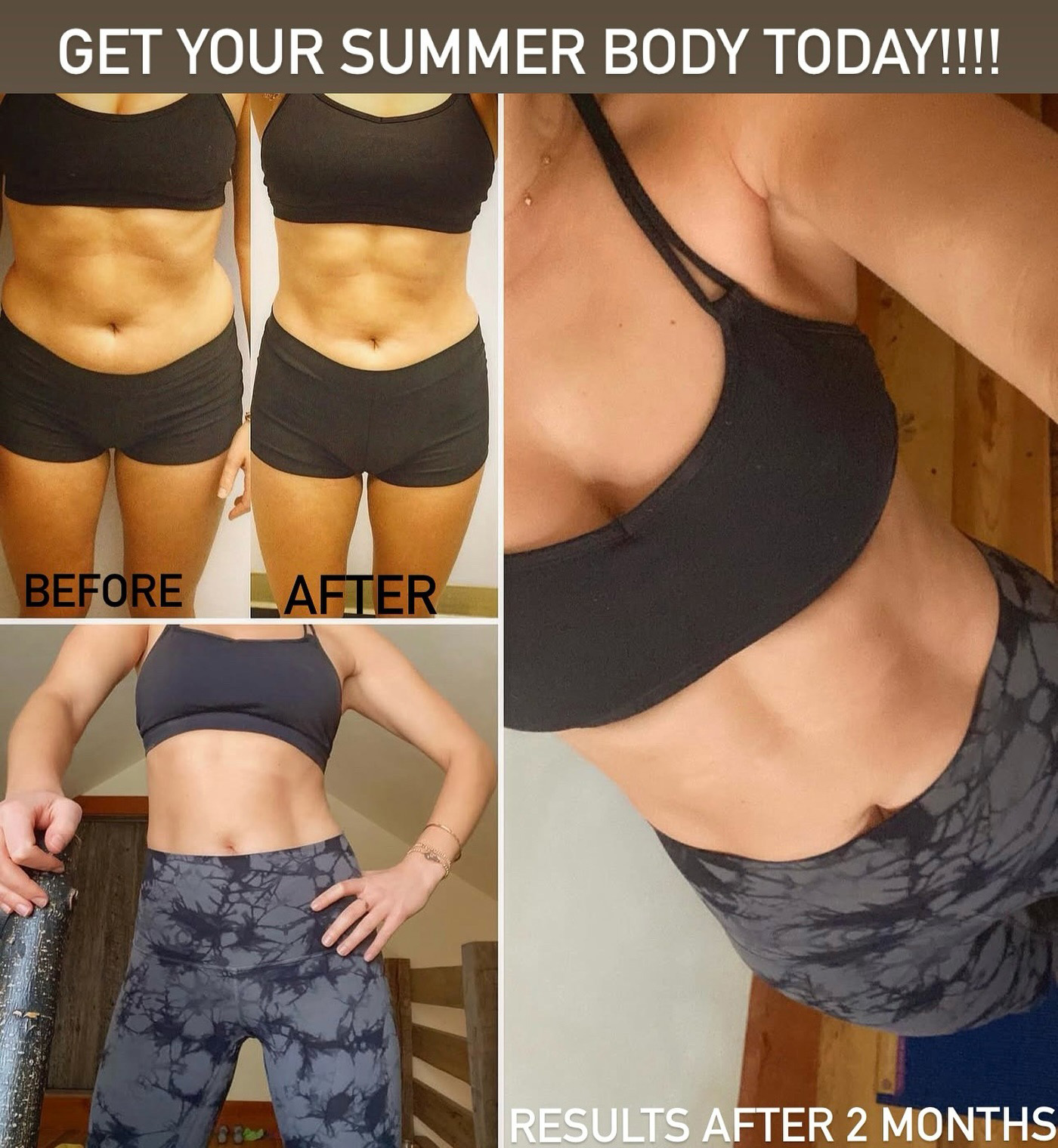 Before and After Body Contouring